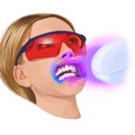 professional teeth whitening, teeth whitening, whiter teeth, dentist in euless
