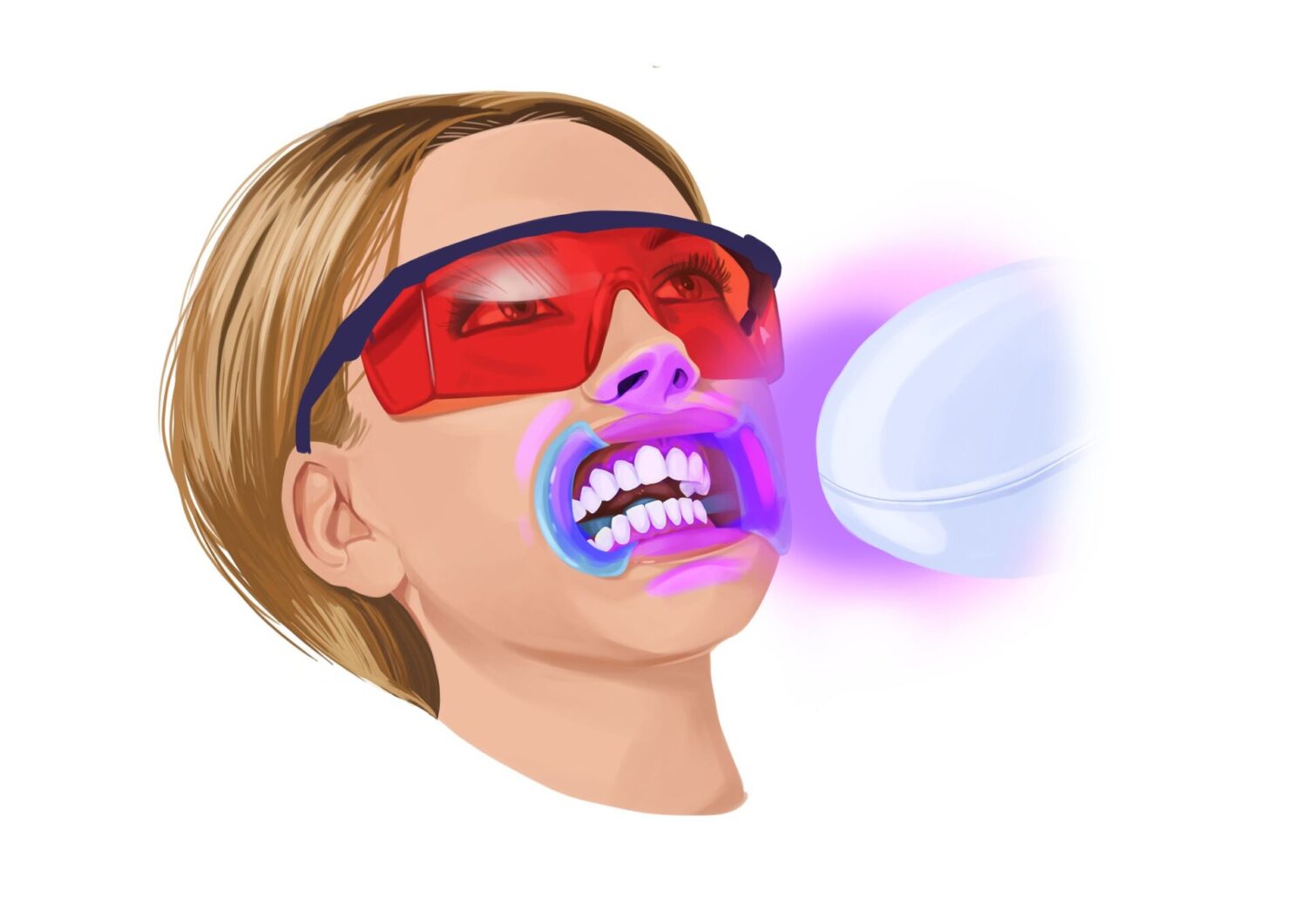 professional teeth whitening, teeth whitening, whiter teeth, dentist in euless
